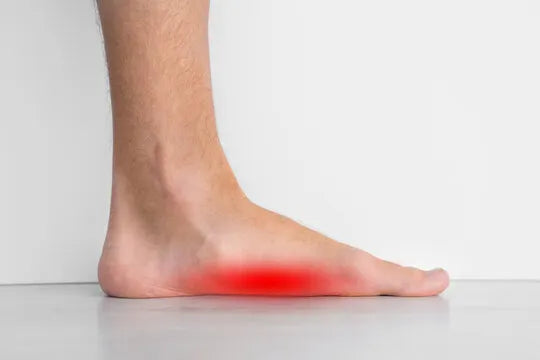 Pieds plats